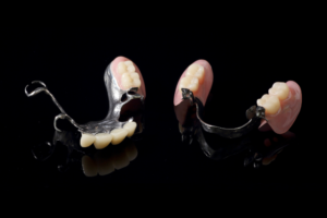 保険の部分入れ歯