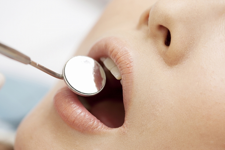 歯を長持ちさせることを最優先に。虫歯を削らない治療法を導入